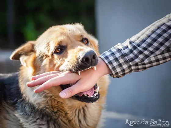 Casi cuatro personas por día son mordidas por un perro en Salta