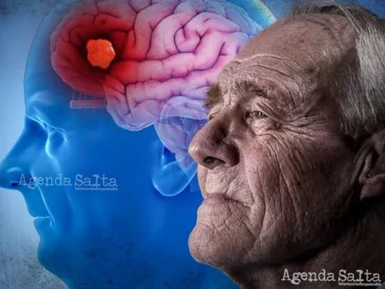 la acumulación temprana de proteínas tau y amiloide-β puede interrumpir la conectividad cerebral muchos años antes de que se observen los signos de deterioro cognitivo