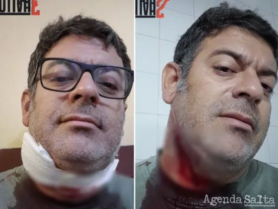 Remisero salteño salió a trabajar y casi lo asesinan: le cortaron el cuello para robarle la recaudación