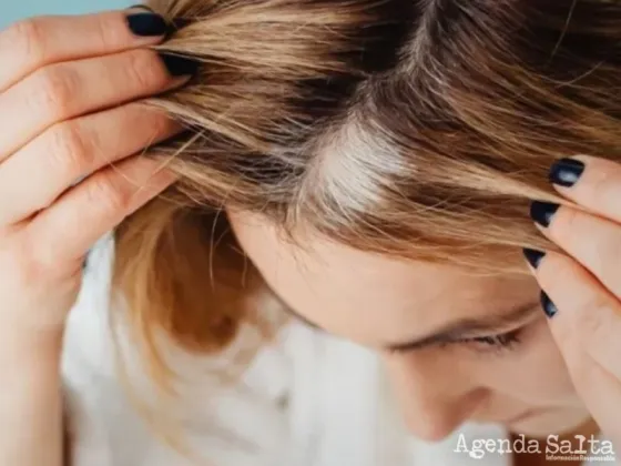 Chau tintura: descubren por qué salen las canas y cómo eliminarlas