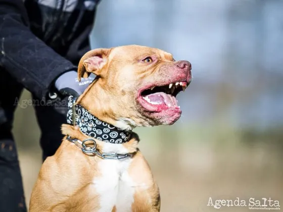 Un pitbull atacó salvajemente a una nena de 10 años: un vecino le salvó la vida