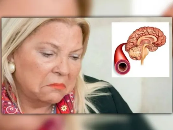 Lilita Carrió sufrió un accidente isquémico transitorio