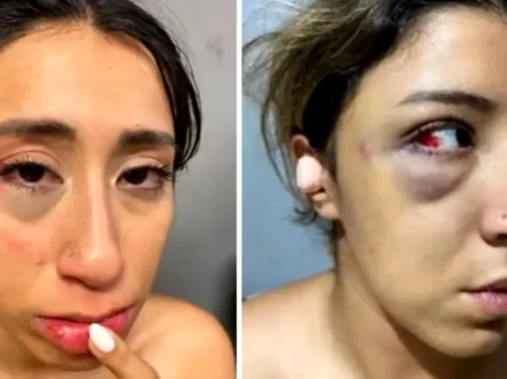 TERRIBLE: dos hermanas fueron atacadas por una patota a la salida de un boliche