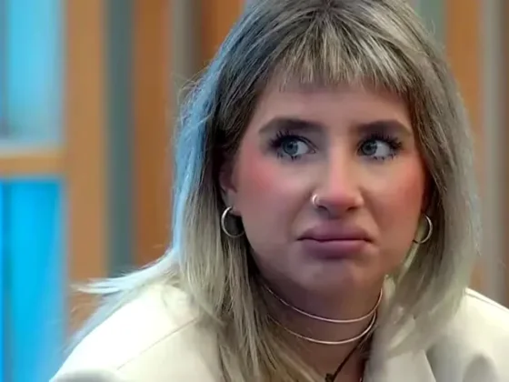 Paloma de Gran Hermano fue al cirujano y contó lo que le encontró en los labios