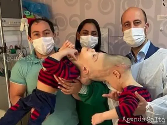 Los gemelos Bernardo y Arthur Lima junto a sus padres y al doctor Noor ul Owase Jeelani antes de la cirugía de separación (Foto: Gemini Untwined).