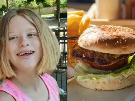 Un nene de 12 años quedó ciego tras alimentarse a base de hamburguesas y donas