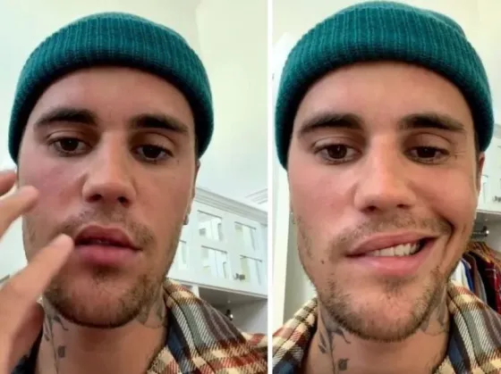 Qué enfermedad tiene Justin Bieber que lo lleva a suspender los shows en Argentina